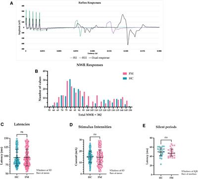 Investigations into an overlooked early component of painful nociceptive withdrawal reflex responses in humans